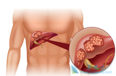 ��������(XL184)��������������ڸΰ�����Ч�Ա�