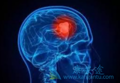 ��������(alectinib)��������Ч�����ڿ�������