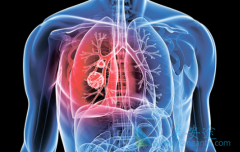 ��Щ�ΰ�����֢״�ͷΰ�����֢״�㶼֪����