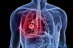 Imfinzi�����ڷΰ��Ż��ƺ�ά�����Ƶı�׼����