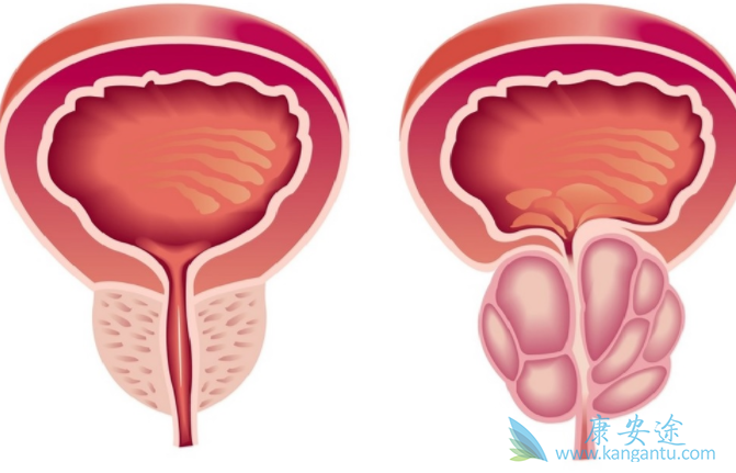 卡博替尼 卡博替尼