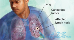 ��Сϸ���ΰ���Сϸ���ΰ�����Щ��ͬ�㣿