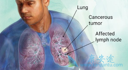 ��Сϸ���ΰ�