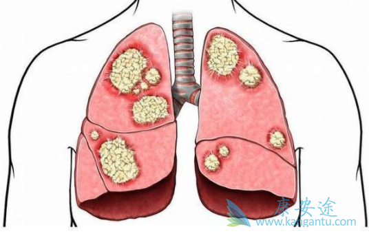 布加替尼 布加替尼