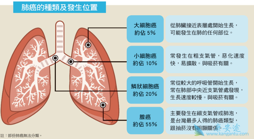 小细胞肺癌 小细胞肺癌