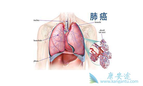 肺癌复发 肺癌复发