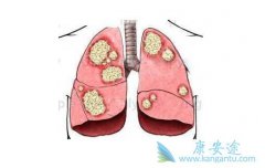 �ΰ����Ƹ����õ���Ҫ�������ļ��㣿