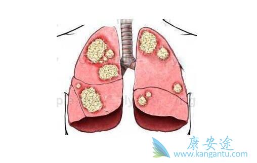 �ΰ����Ƹ�����