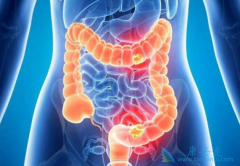 ���ᵥ��(Panitumumab)������Ч������Щ����Ӱ�죿