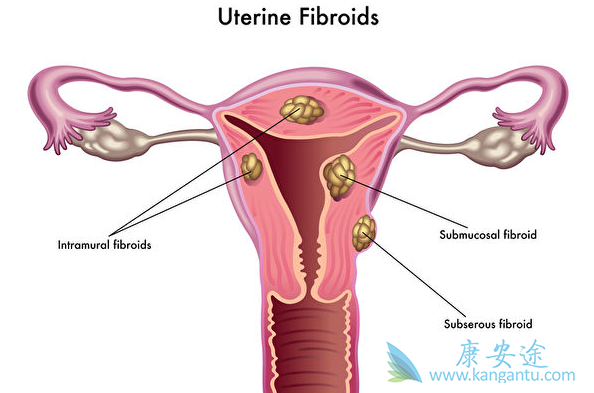 宫颈鳞癌 宫颈鳞癌