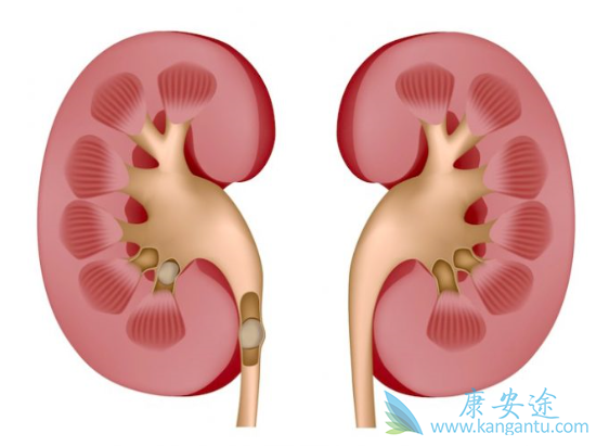 ����ת��