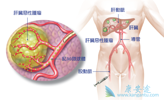 ����������˨��