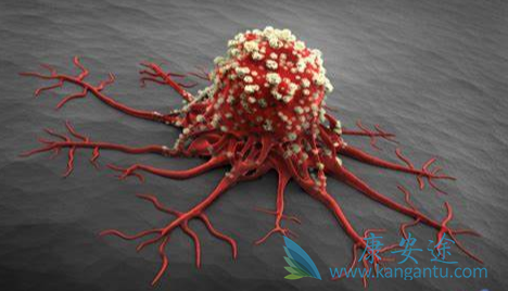 癌症治疗;癌症转移 癌症治疗;癌症转移