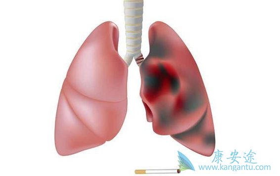 �ΰ���֢״;���Ʒΰ�