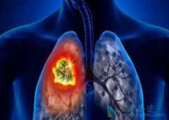 �������ƶԷΰ���Ч����ô���� ������