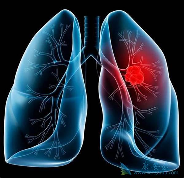 �ΰ���Ԥ��