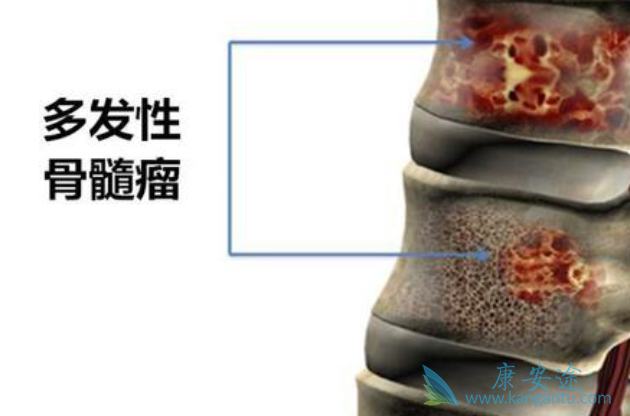 �������ܻ���