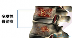 �෢�Թ��������ߵ�֢״����Щ��