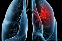 ��������Կ���������ҩ��ROS1ͻ��ΰ���Ч��