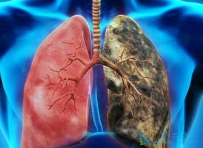 �ΰ���ת��