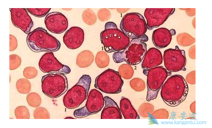 ������Ѫ��