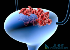 Erdafitinib���׸����ư��װ��İ���ҩ