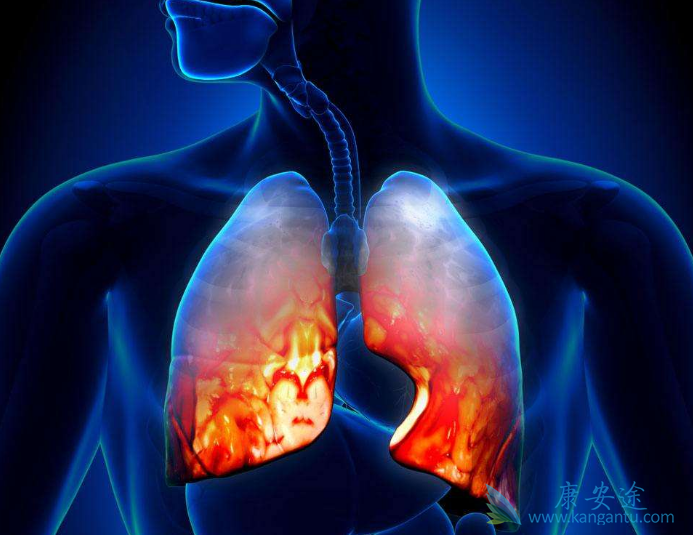 转移性肺癌 转移性肺癌