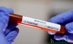 ������Τ�������͹�״�������׵��ٴ�ЧӦ